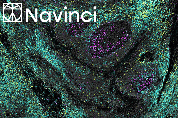 Who with Whom? Visualising Protein Relationships with Naveni® Plex from Navinci