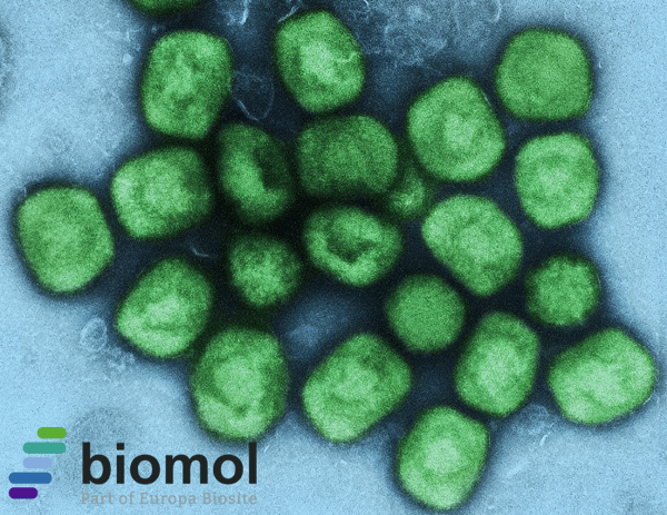 Mpox – On the Way to the Next Pandemic?