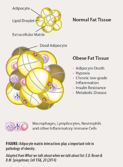 Obesity and Diabetes