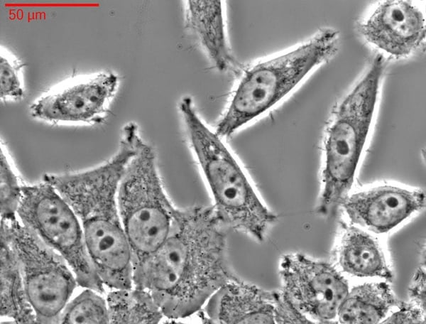 Henrietta Lacks' Immortal Cells
