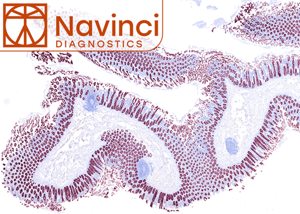 Fully Automated in situ Proximity Ligation Assays from Navinci Diagnostics