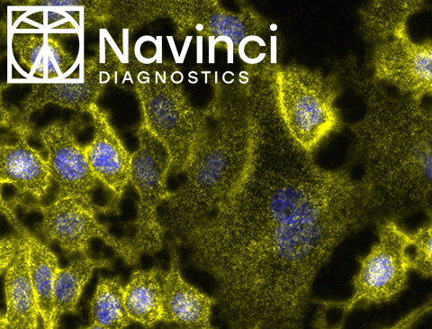 New: NaveniFlex Cell and NaveniFlex Tissue by Navinci Diagnostics
