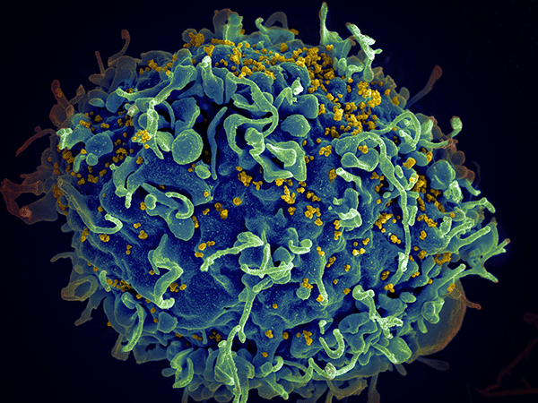HIV Cure made in Hamburg?