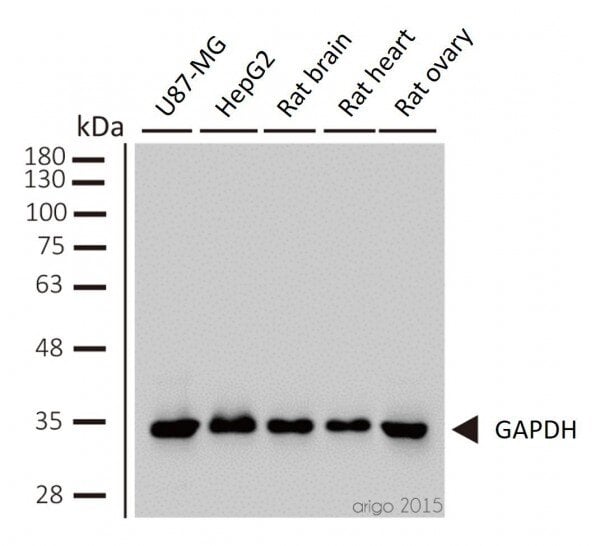 Western Blot Loading Controls
