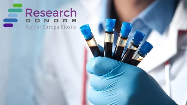 Healthy Blood Biospecimens for Research: Whole Blood, PBMCs, Leukopaks & more